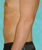 Patient # 12526 After Photo # 2
